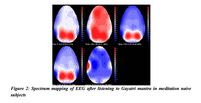 spectrum-mapping-eeg-after-listening-gaytri-mantra